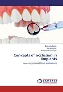 Concepts of occlusion in Implants - Barjinder Singh Navreet Sohi Karanprakash Singh