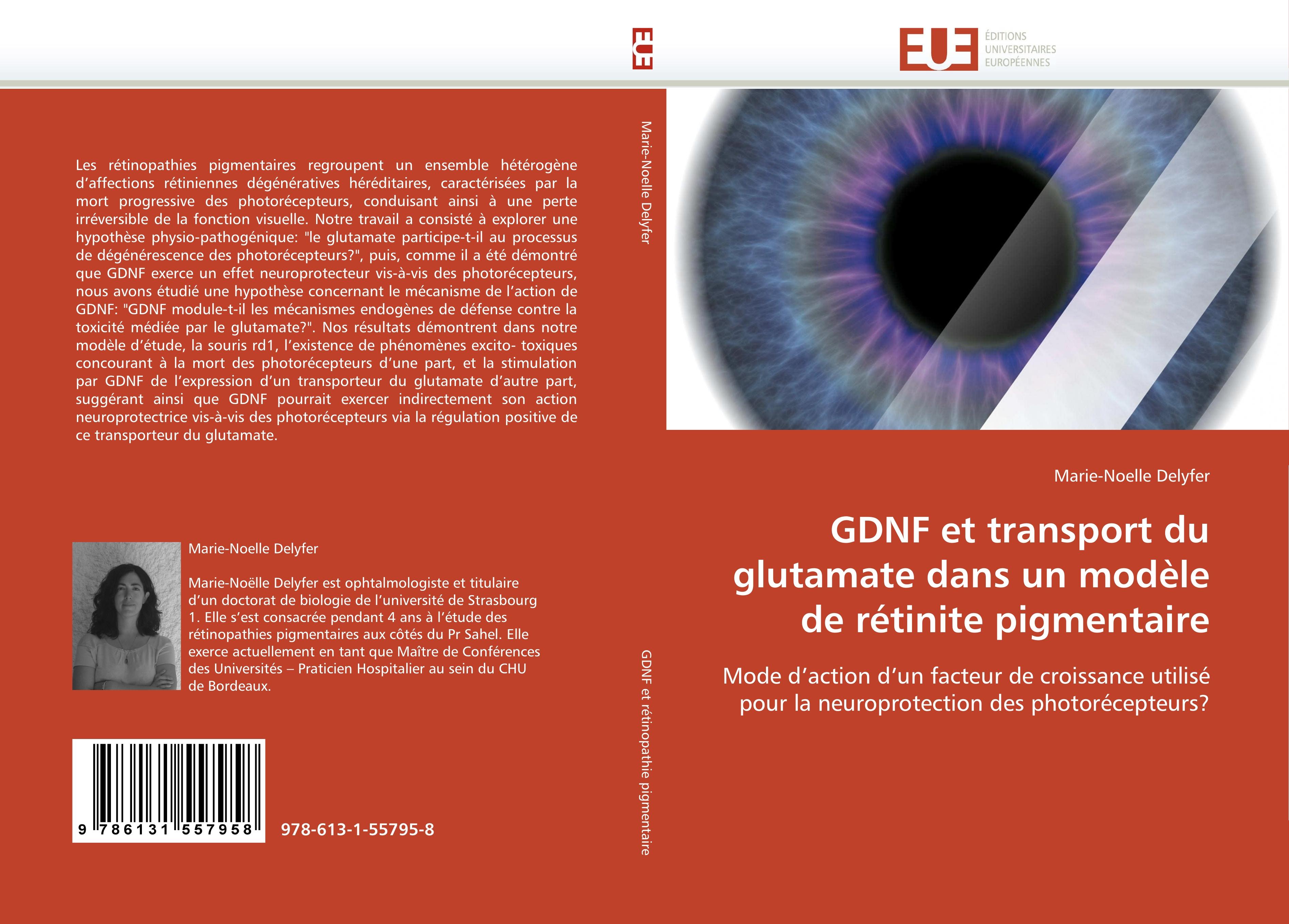 GDNF et transport du glutamate dans un modèle de rétinite pigmentaire - Marie-Noelle Delyfer