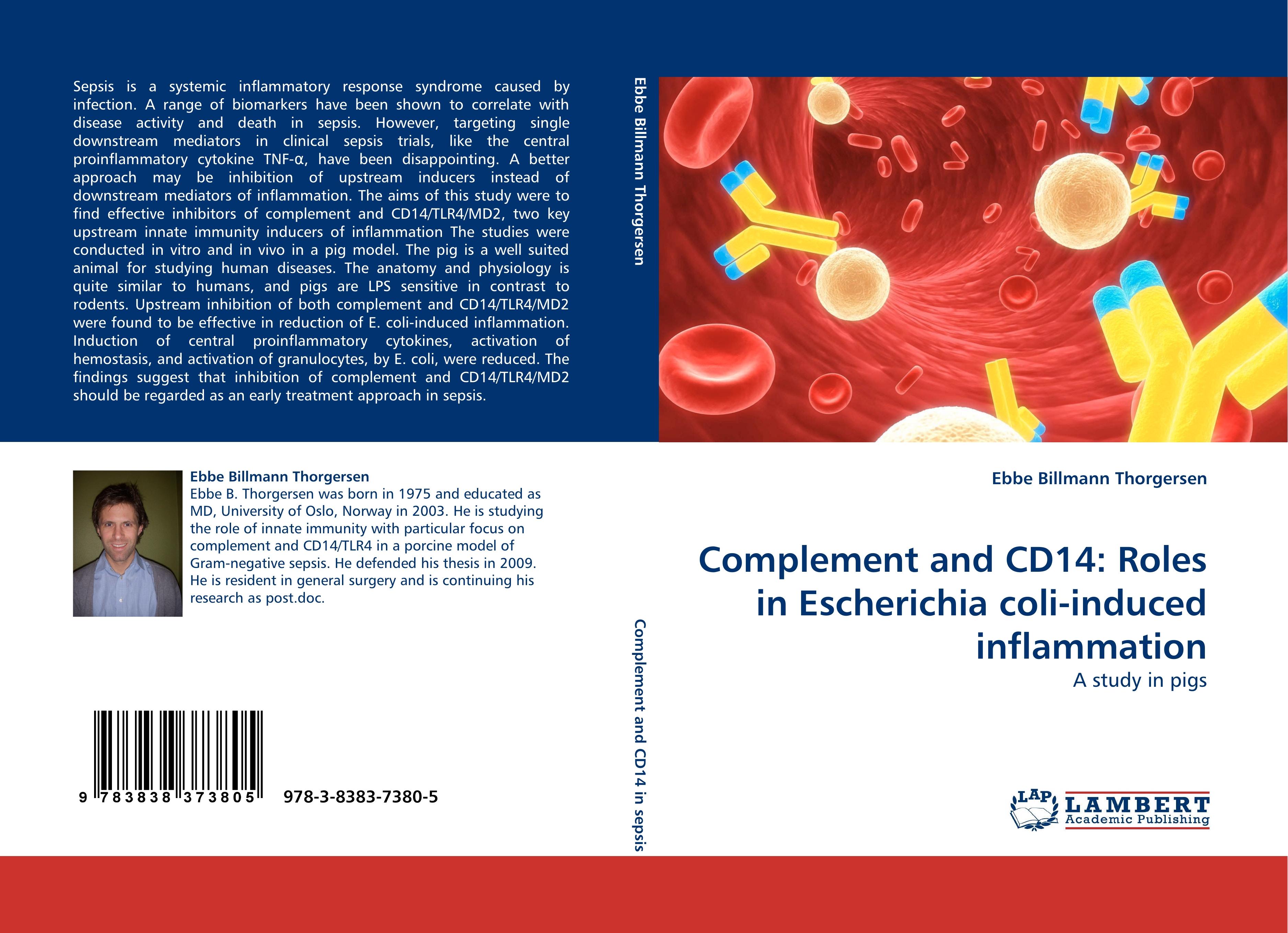 Complement and CD14: Roles in Escherichia coli-induced inflammation - Ebbe Billmann Thorgersen