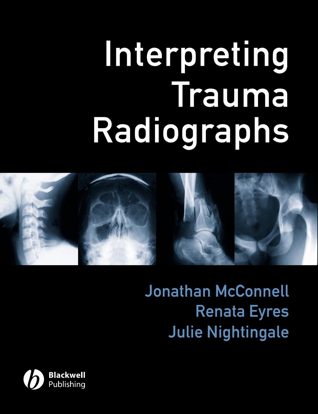 Interpreting Trauma Radiographs - Mcconnell Eyres Nightingale J