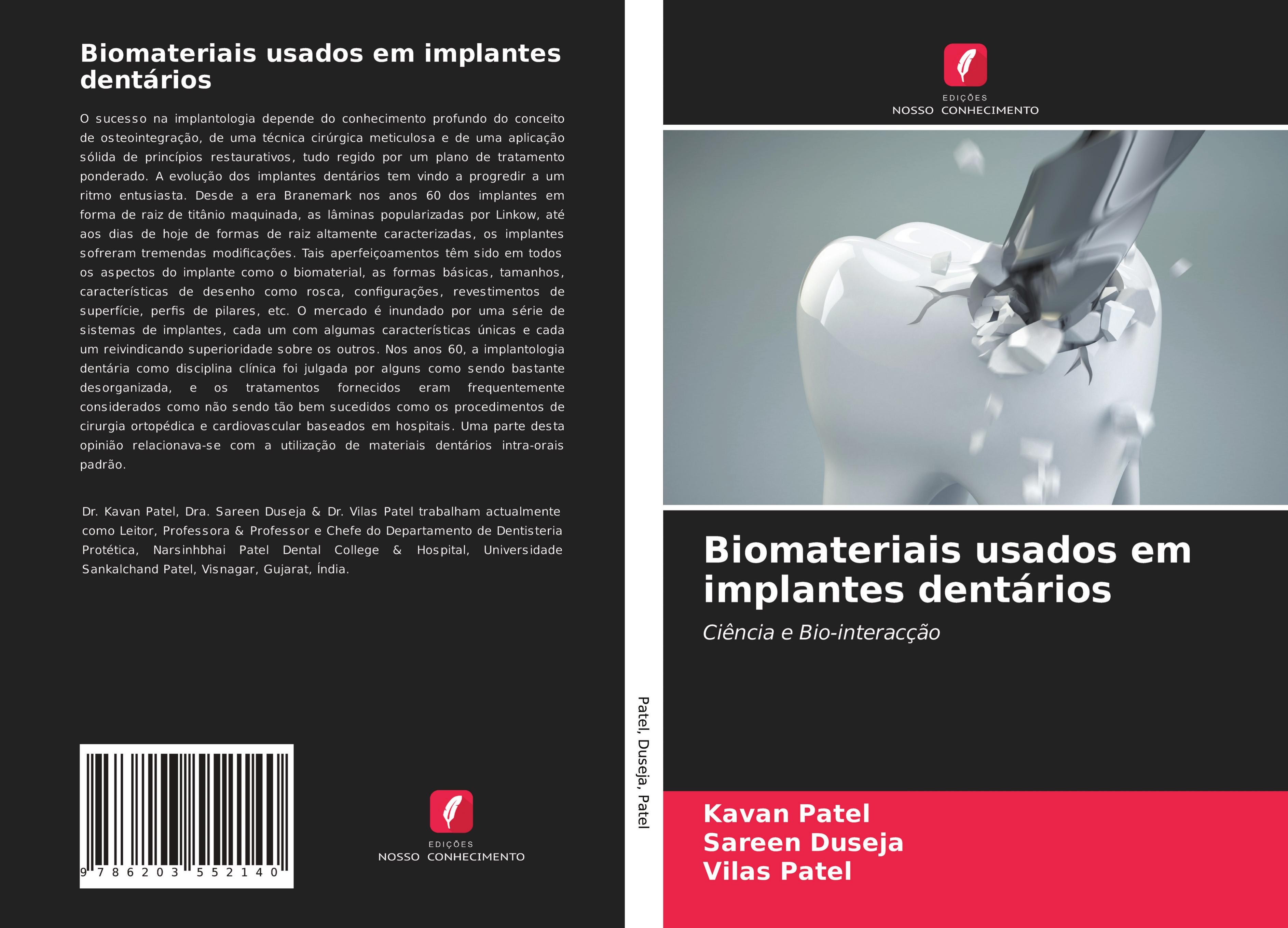 Biomateriais usados em implantes dentários - Patel, Kavan Duseja, Sareen Patel, Vilas