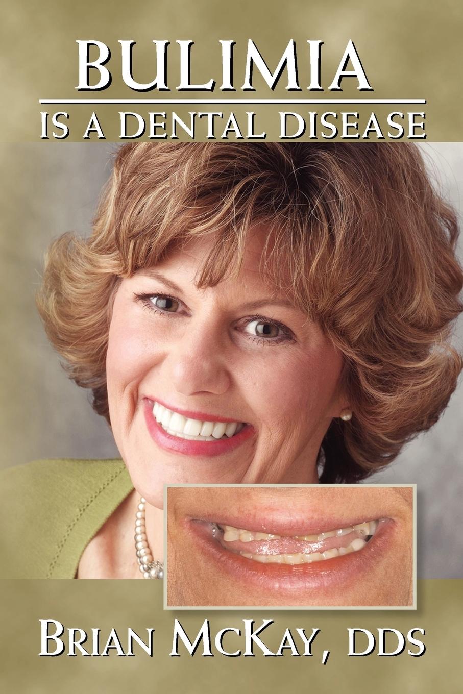 Bulimia Is a Dental Disease - McKay, Brian Dds