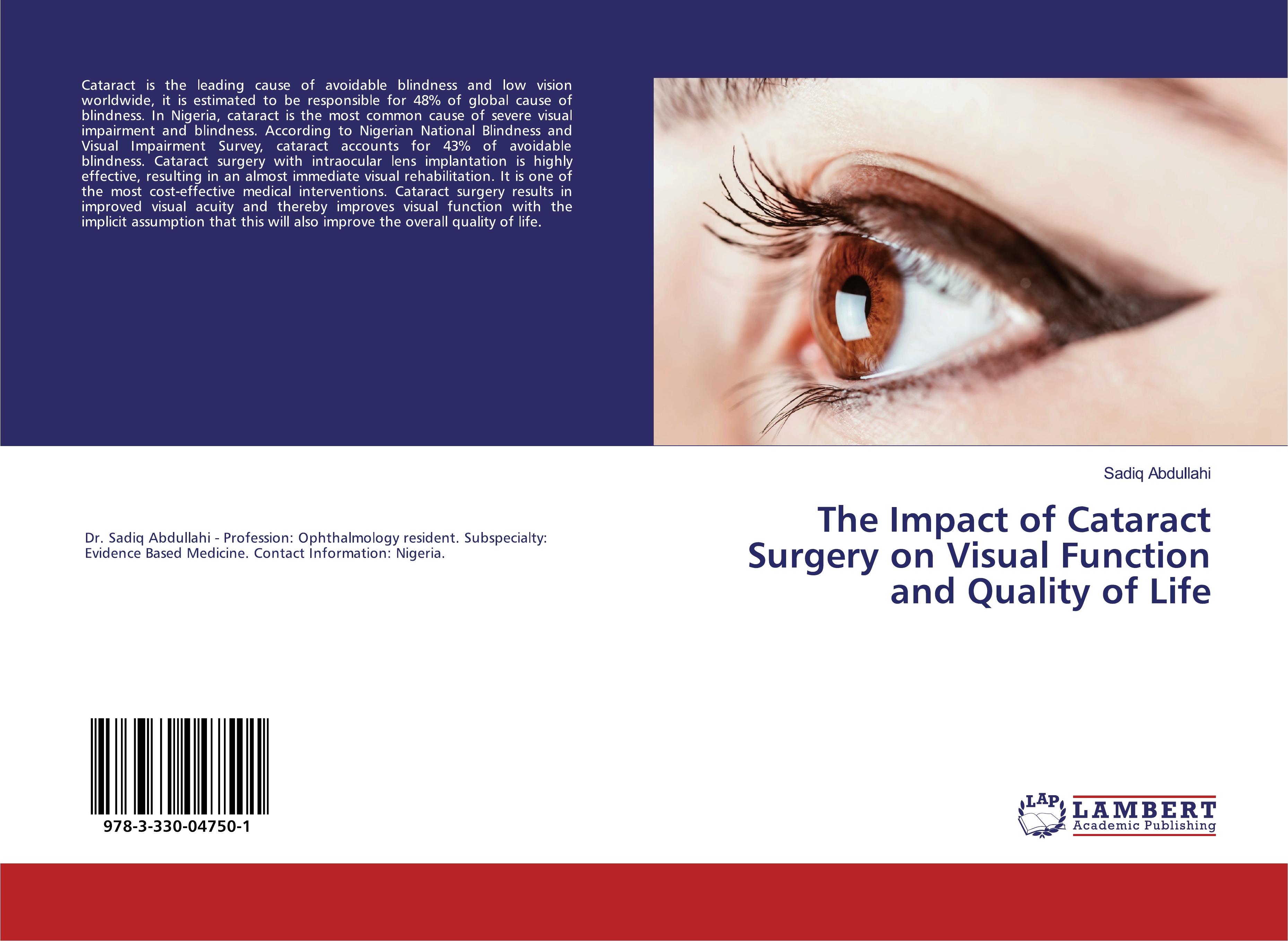 The Impact of Cataract Surgery on Visual Function and Quality of Life - Sadiq Abdullahi