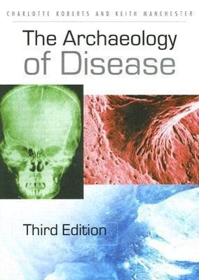 ARCHAEOLOGY OF DISEASE 3/E - Roberts, Charlotte Manchester, Keith