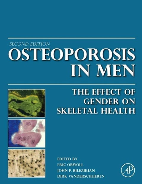 Osteoporosis in Men - Orwoll, Eric S. Bilezikian, John P. Vanderschueren, Dirk