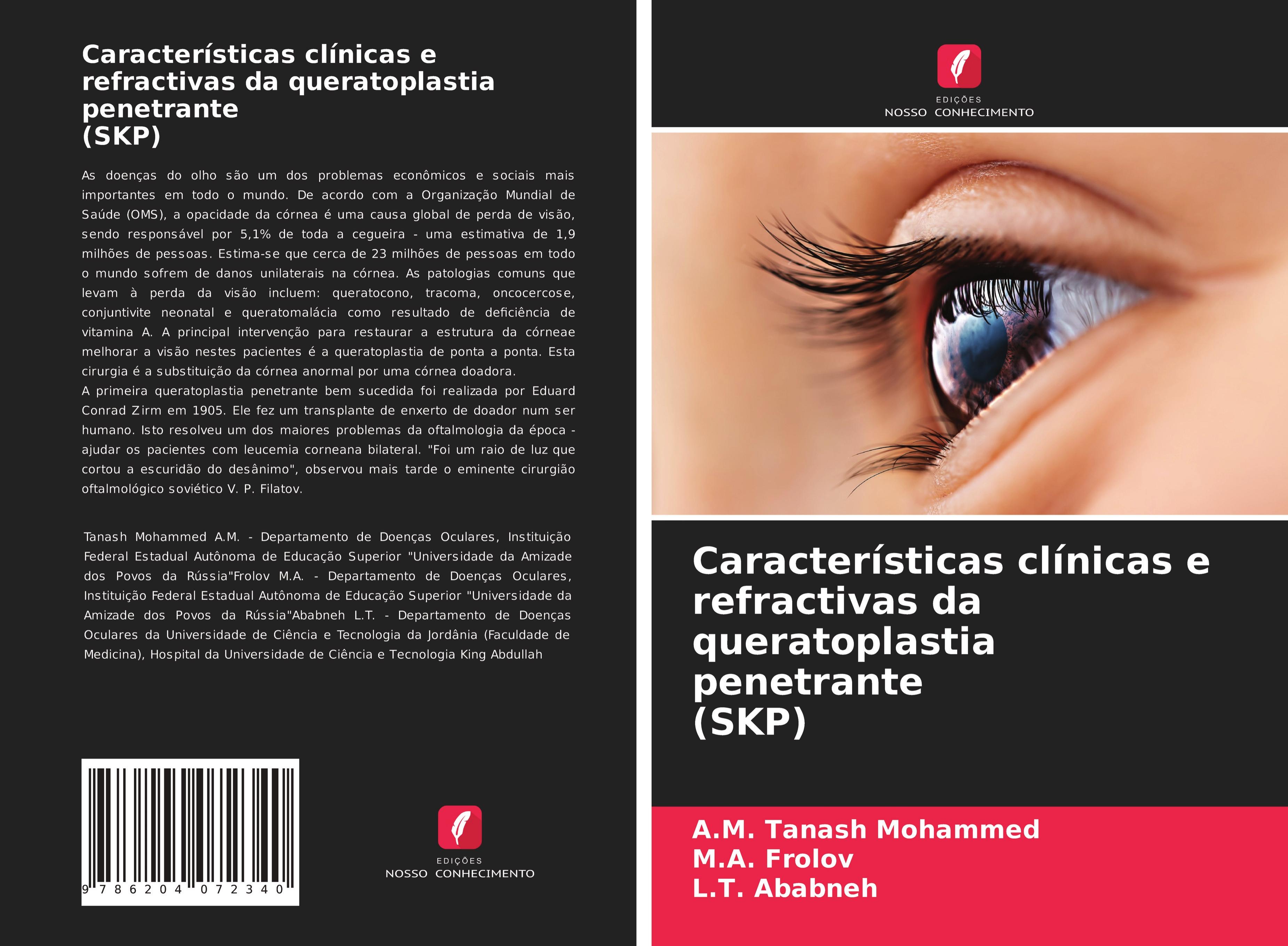 Características clínicas e refractivas da queratoplastia penetrante (SKP) - Tanash Mohammed, A.M. Frolov, M.A. Ababneh, L.T.
