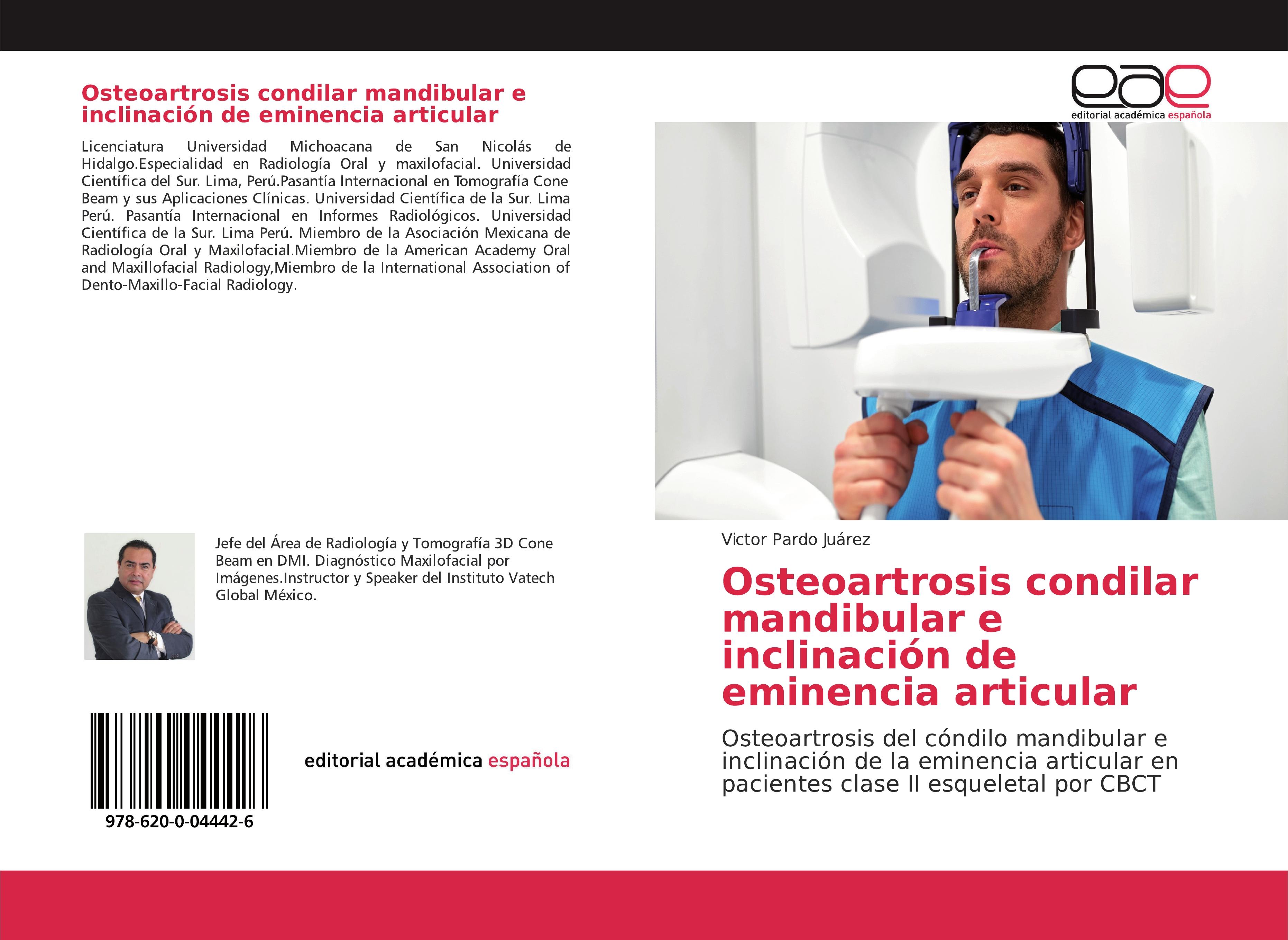 Osteoartrosis condilar mandibular e inclinación de eminencia articular - Victor Pardo Juárez