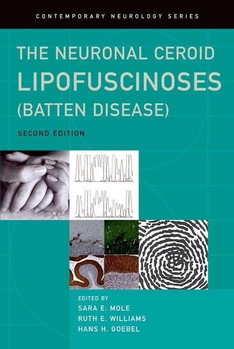 The Neuronal Ceroid Lipofuscinoses (Batten Disease) - Mole, Sara Williams, Ruth Goebel, Hans