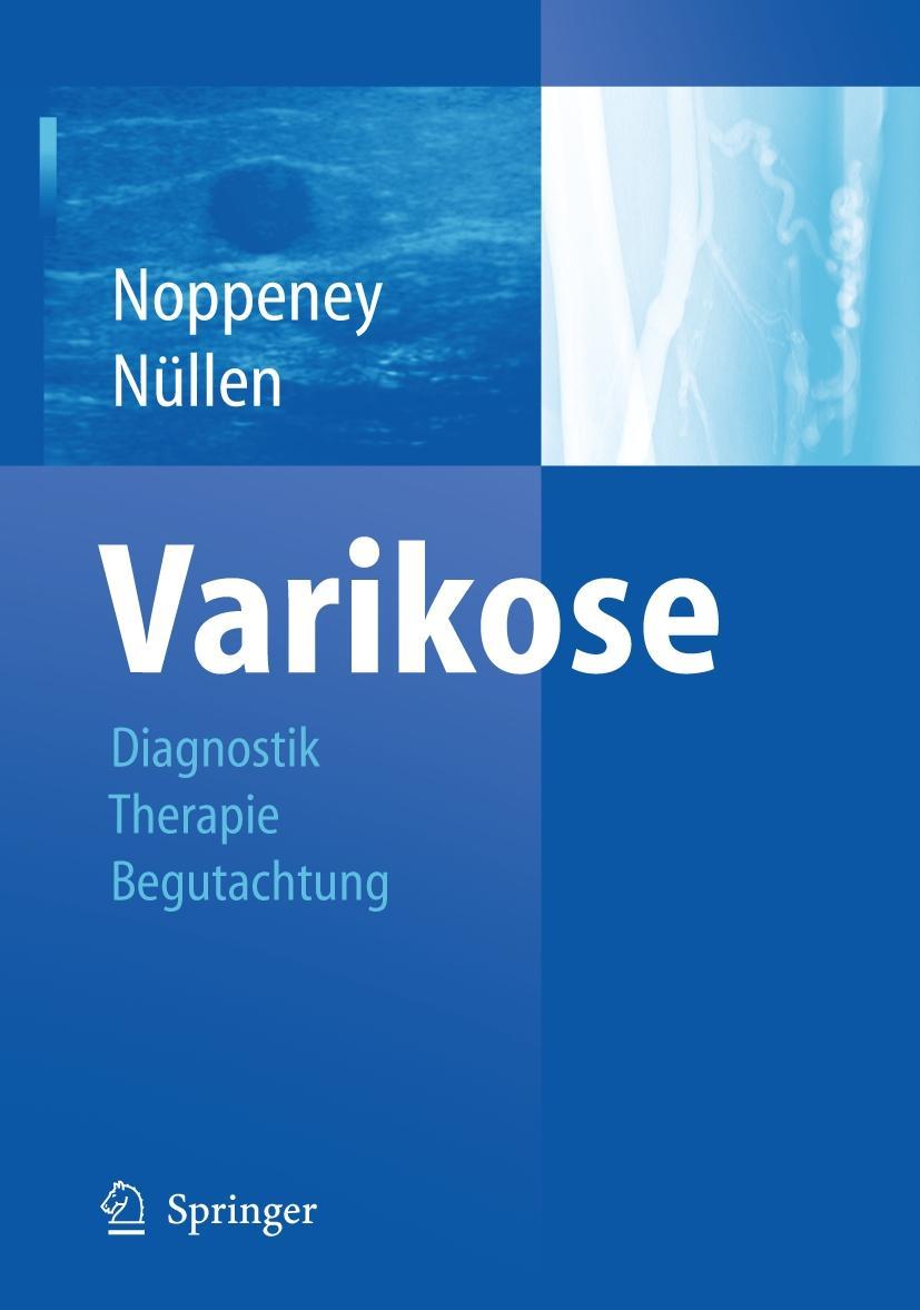 Varikose Noppeney, Thomas Nüllen, Helmut