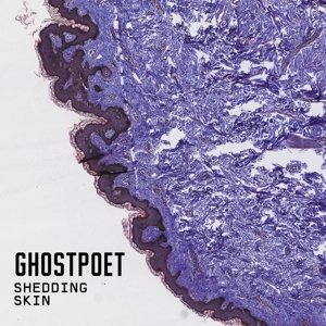 Shedding Skin (LP+CD)