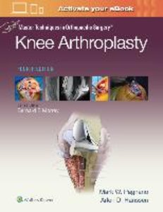 Master Techniques in Orthopedic Surgery: Knee Arthroplasty (Master Techniques in Orthopaedic Surgery)