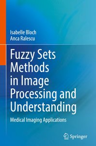 Fuzzy Sets Methods in Image Processing and Understanding
