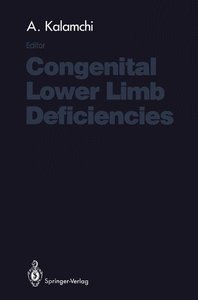 Congenital Lower Limb Deficiencies