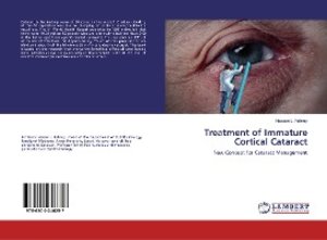 Treatment of Immature Cortical Cataract